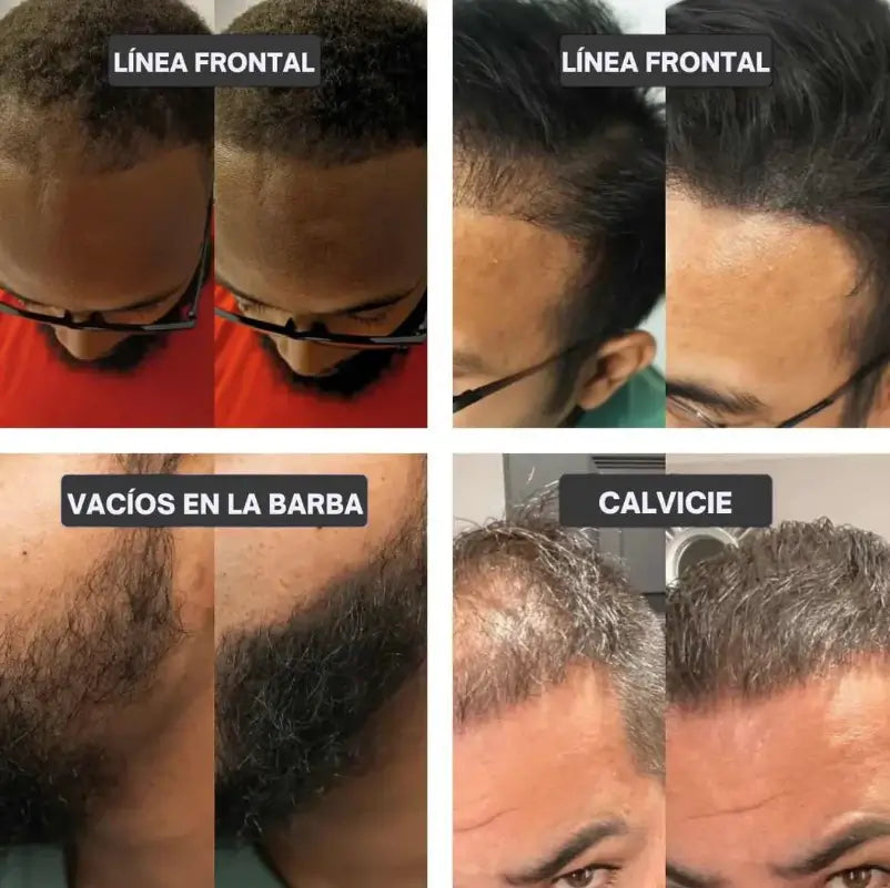 CORRECTOR PARA ENTRADAS- Paga 1 Lleva 2 - NO ERES EL ÚNICO. Y POR ESO HOY TE LLEVAS DOS AL PRECIO DE UNO